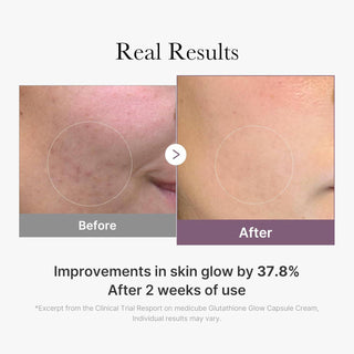 MEDICUBE Age-R Glutathione Glow Capsule Cream 50mL - Kbeauty Canada