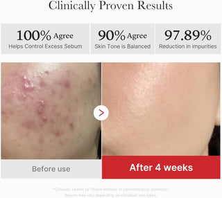 MEDICUBE Red Succinic Acid Peeling Pad 155g