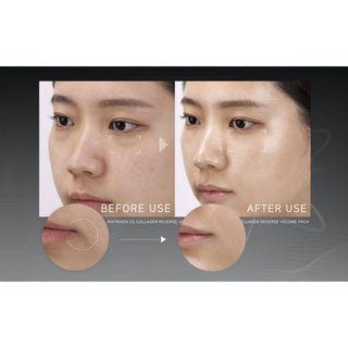 Matrigen SS Collagen Reverse Volume Pack ORIGINAL + 1 Spatula (Limited Quantity) - Kbeauty Canada