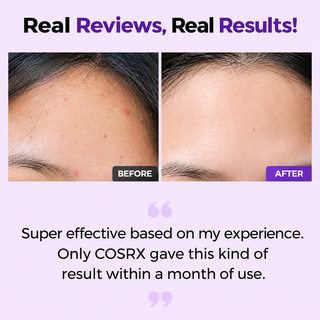 COSRX AHA/BHA Clarifying Treatment Toner – Best Pore Tightening Toner