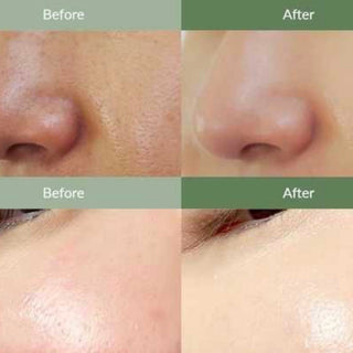Dr. Althea Premium Quick Step Sebum Cleanser 100 ml - Kbeauty Canada