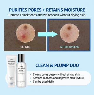 Jumiso Pore-Purifying Salicylic Acid Foaming Cleanser in 120g tube, showing the cleanser's packaging and product label.