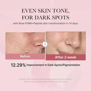 MEDICUBE PDRN Pink Niacinamide Milky Toner 150mL - Kbeauty Canada