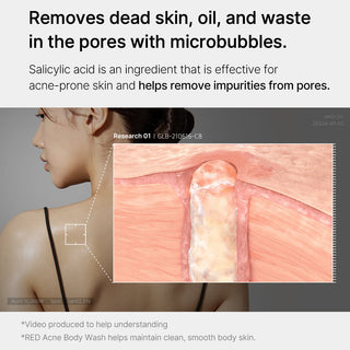 MEDICUBE Red Acne Body Wash