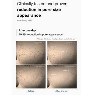 MEDICUBE Zero Pore One Day Serum 30mL