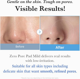 MEDICUBE Zero Pore Pad Mild (70pcs)