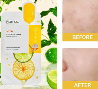 MEDIHEAL Vita Essential Mask 24mL (1ea) - Kbeauty Canada