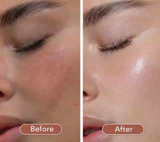 SKIN1004 Madagascar Centella Probio-Cica Intensive Ampoule - Kbeauty Canada