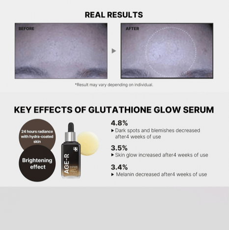 what are natural sources of glutathione Top 10 Foods Rich in Glutathione for Natural Detox & Skin Glow – Chicnutrix what are natural sources of glutathione Top 10 Foods Rich in Glutathione for Natural Detox & Skin Glow – Chicnutrix