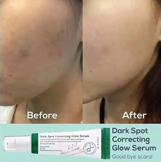 Axis-Y Dark Spot Correcting Glow Serum in a sleek bottle, designed to reduce pigmentation and brighten skin.