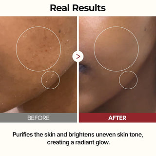 Dr.Melaxin Peel Shot Glow Rice Toner 200ml bottle with clear label and white cap, designed for brightening skin.