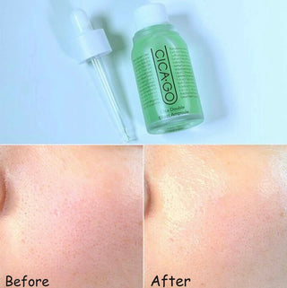 ISOI Cicago Cica Double Effect Ampoule 30mL bottle with clear liquid and dropper applicator, skincare product for soothing and repairing.
