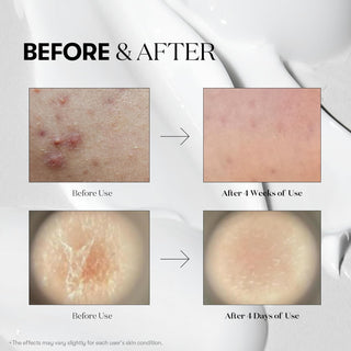 VT Cosmetics Collagen Pink Reedle Shot 300 ampoule bottle with pink design and dropper for skincare.