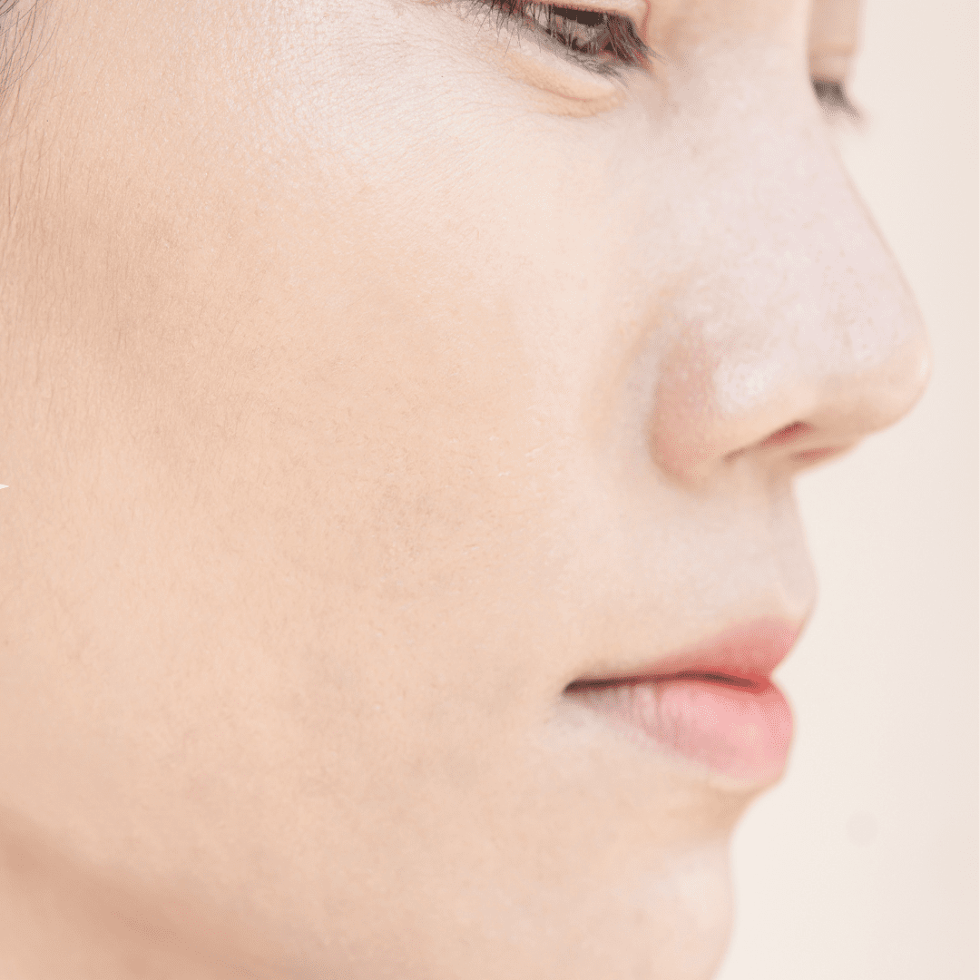 Shiseido Senka Perfect Whip Acne Care